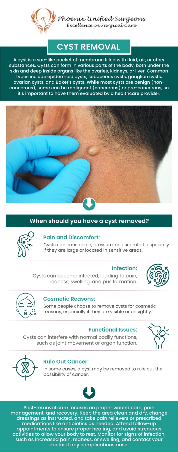 The cost of cyst removal surgery depends on several factors, including the size and location of the cyst, the complexity of the procedure, and the type of anesthesia required. Additional costs may include pathology fees for lab analysis and follow-up care. Dr. Antonino Cammarata, D.O., at Phoenix Unified Surgeons ensures transparent pricing and provides clear cost estimates during your consultation. For more information, contact us or request an appointment online. We are conveniently located at 20333 N 19th Avenue, Ste 230 Phoenix, AZ 85027.