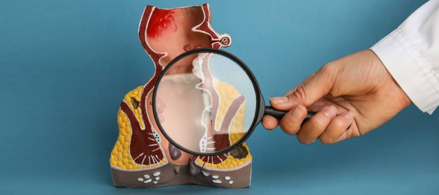 What Are Colon Fistulas and How Are They Treated in Phoenix, AZ?
