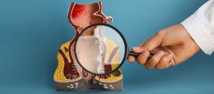 What Are Colon Fistulas and How Are They Treated in Phoenix, AZ?