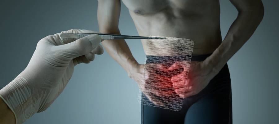 What Causes Inguinal Hernias and How Are They Treated in Phoenix, AZ?
