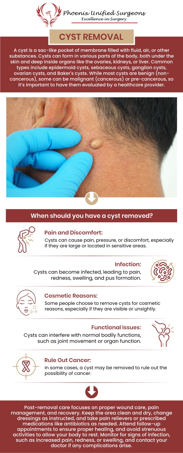 Cysts are often caused by blockages in glands or hair follicles, infections, or genetic conditions. They can develop anywhere on the body and vary in size. If a cyst becomes painful or infected, it may need to be removed by Dr. Antonino Cammarata, D.O., at Phoenix Unified Surgeons to prevent recurrence. For more information, contact us or request an appointment online. We are conveniently located at 20333 N 19th Avenue, Ste 230 Phoenix, AZ 85027. Cysts are often caused by blockages in glands or hair follicles, infections, or genetic conditions. They can develop anywhere on the body and vary in size. If a cyst becomes painful or infected, it may need to be removed by Dr. Antonino Cammarata, D.O., at Phoenix Unified Surgeons to prevent recurrence. For more information, contact us or request an appointment online. We are conveniently located at 20333 N 19th Avenue, Ste 230 Phoenix, AZ 85027.