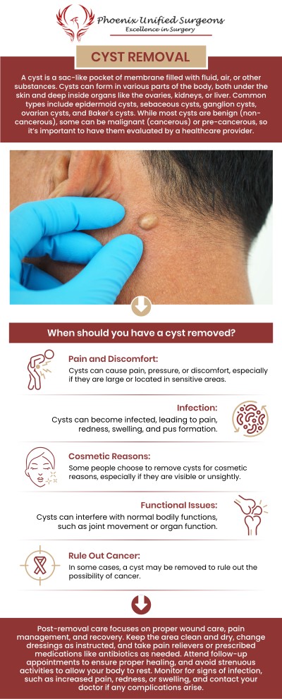 Cysts are often caused by blockages in glands or hair follicles, infections, or genetic conditions. They can develop anywhere on the body and vary in size. If a cyst becomes painful or infected, it may need to be removed by Dr. Antonino Cammarata, D.O., at Phoenix Unified Surgeons to prevent recurrence. For more information, contact us or request an appointment online. We are conveniently located at 20333 N 19th Avenue, Ste 230 Phoenix, AZ 85027. Cysts are often caused by blockages in glands or hair follicles, infections, or genetic conditions. They can develop anywhere on the body and vary in size. If a cyst becomes painful or infected, it may need to be removed by Dr. Antonino Cammarata, D.O., at Phoenix Unified Surgeons to prevent recurrence. For more information, contact us or request an appointment online. We are conveniently located at 20333 N 19th Avenue, Ste 230 Phoenix, AZ 85027.
