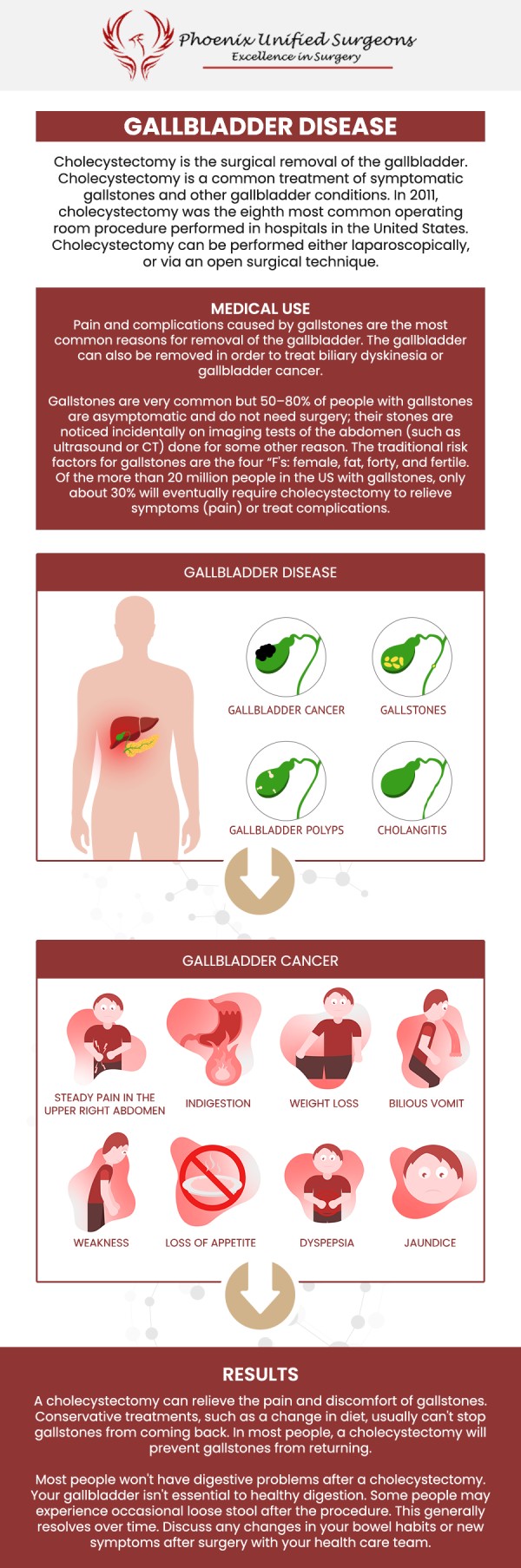 If you're experiencing persistent abdominal pain, nausea, or digestive issues, it may be time to see a gallbladder surgeon. The professional staff at Phoenix Unified Surgeons offers evaluation and treatment options to address your symptoms and improve your health. For more information, contact us or book your appointment online. Our office is conveniently located at 20333 N 19th Avenue, Ste 230 Phoenix, AZ 85027. If you're experiencing persistent abdominal pain, nausea, or digestive issues, it may be time to see a gallbladder surgeon. The professional staff at Phoenix Unified Surgeons offers evaluation and treatment options to address your symptoms and improve your health. For more information, contact us or book your appointment online. Our office is conveniently located at 20333 N 19th Avenue, Ste 230 Phoenix, AZ 85027.